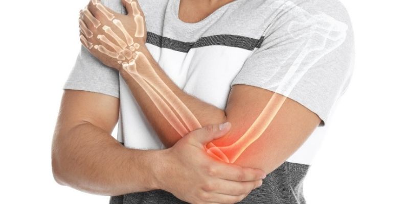 Tenisçi dirseği, dirsek dış bölgesindeki tendonların iltihaplanmasıyla oluşan yaygın bir ağrı tablosudur. Belirtileri, nedenleri ve tedavi yöntemlerini öğrenin